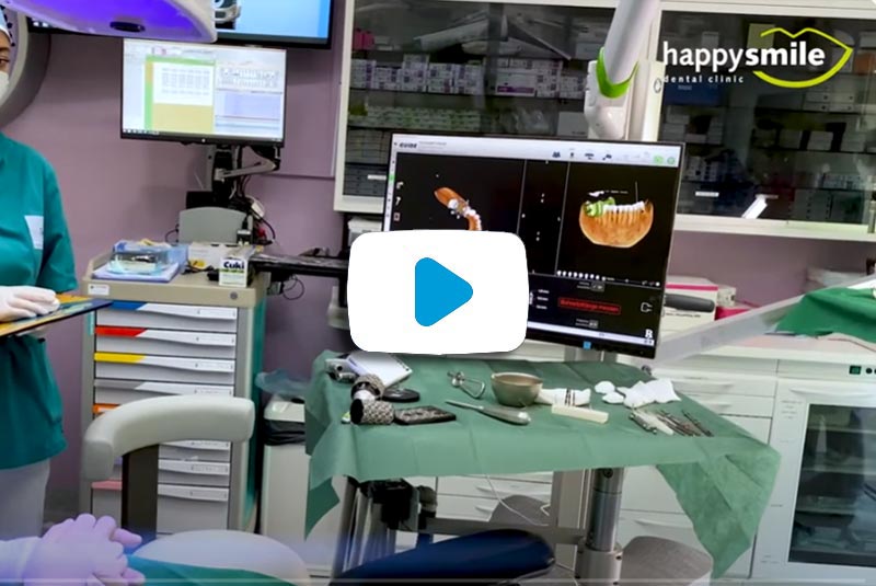 Video Implantat OP
